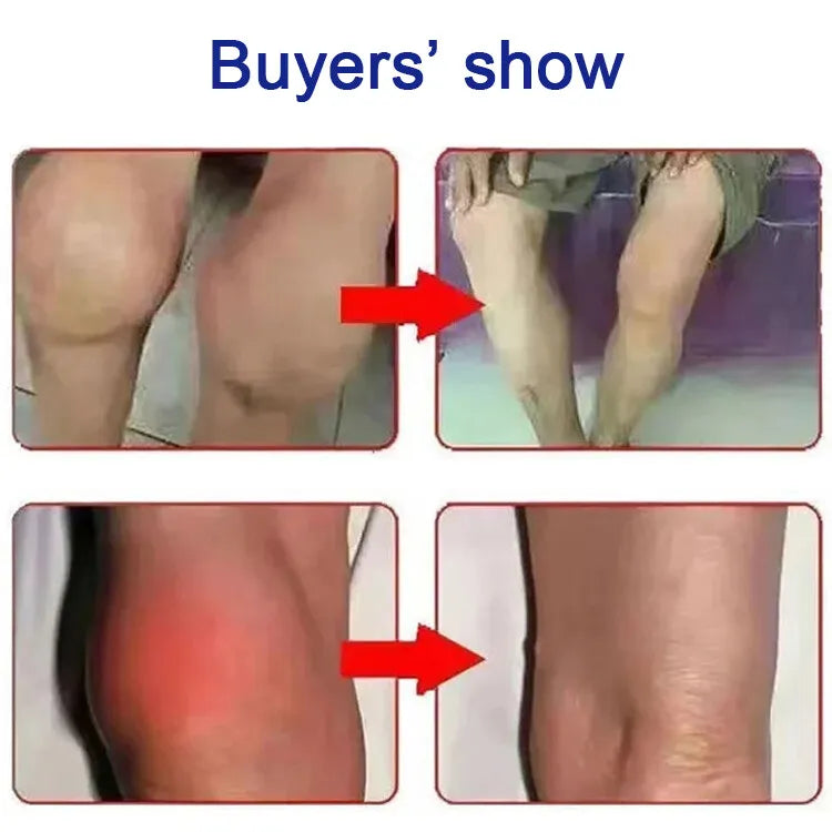 Herbal Pain Relief Patches🔥BUY 2 GET 2 FREE🔥