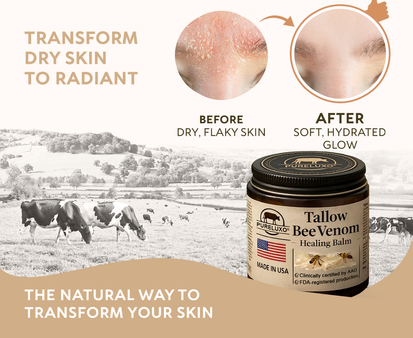 【70% OFF Ends Today】Pureluxo® 🐄Tallow Bee Venom Healing Balm（Targets Bumps, Wrinkles & Stressed Skin — Without Steroids）