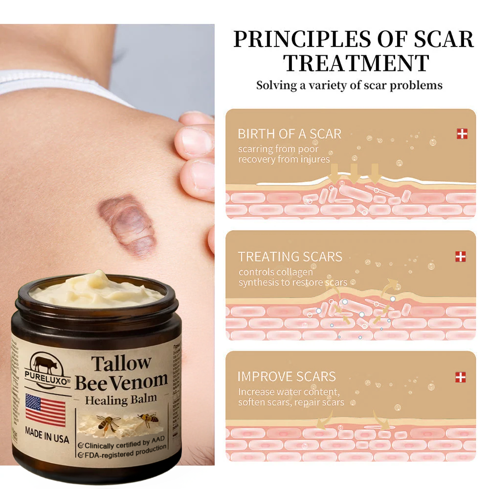 【70% OFF Ends Today】Pureluxo® 🐄Tallow Bee Venom Healing Balm（Targets Bumps, Wrinkles & Stressed Skin — Without Steroids）