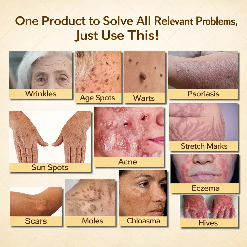 【70% OFF Ends Today】Pureluxo® 🐄Tallow Bee Venom Healing Balm（Targets Bumps, Wrinkles & Stressed Skin — Without Steroids）