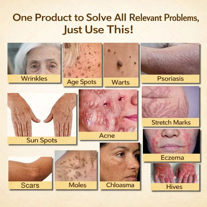 【70% OFF Ends Today】Pureluxo® 🐄Tallow Bee Venom Healing Balm（Targets Bumps, Wrinkles & Stressed Skin — Without Steroids）