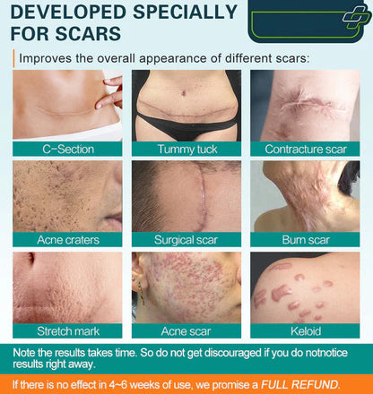 Scar Remove – Medical Grade Scar Spray(For example Acne Scars, Surgical Scars and Stretch Marks ⚡️⚡️⚡️)