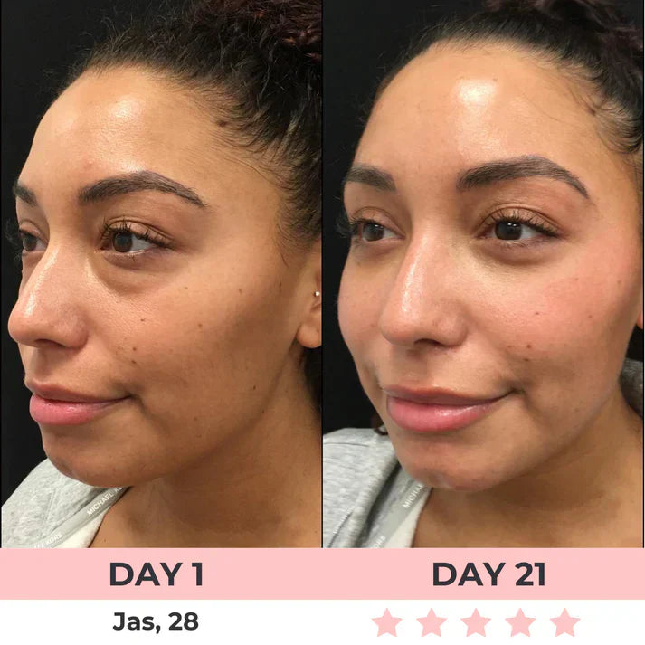 🎁Last day of the event: 80% discount!💥  Eye massager